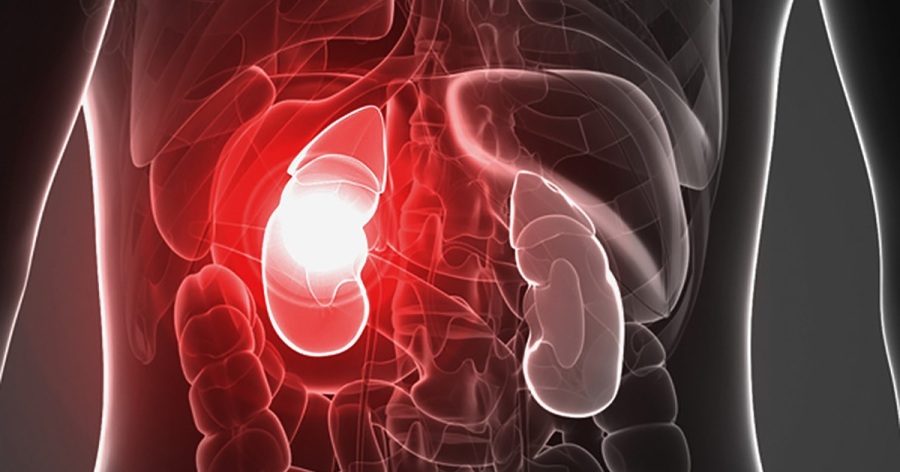 Food Supplements & Other Problems That Can Affect The Kidneys